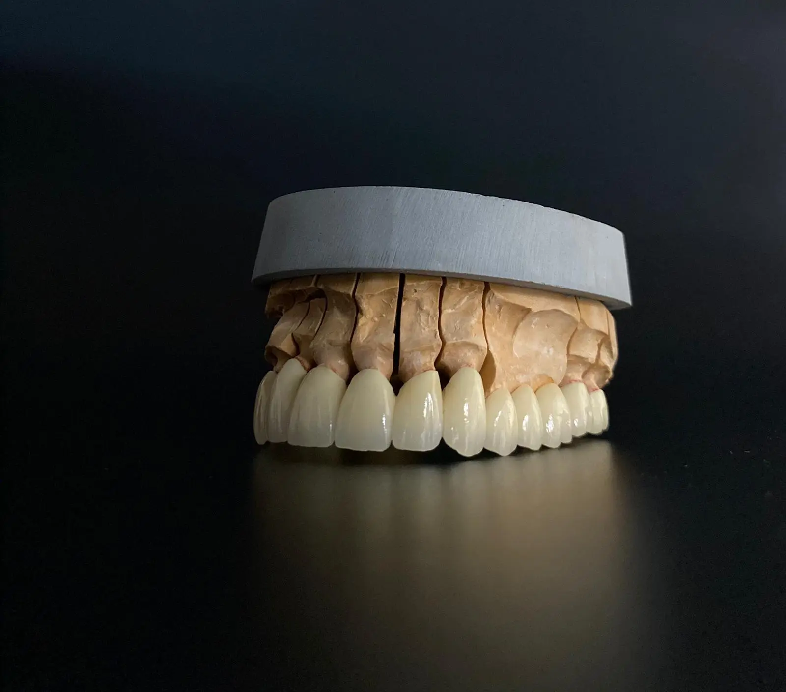 Laboratoire de prothèses dentaires - Équipe professionnelle